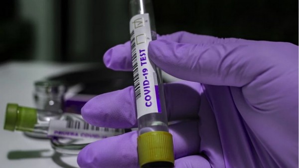 Вспышка коронавируса произошла в доме-интернате для престарелых в Самаре Вспышка коронавируса произошла в доме-интернате для престарелых в Самаре